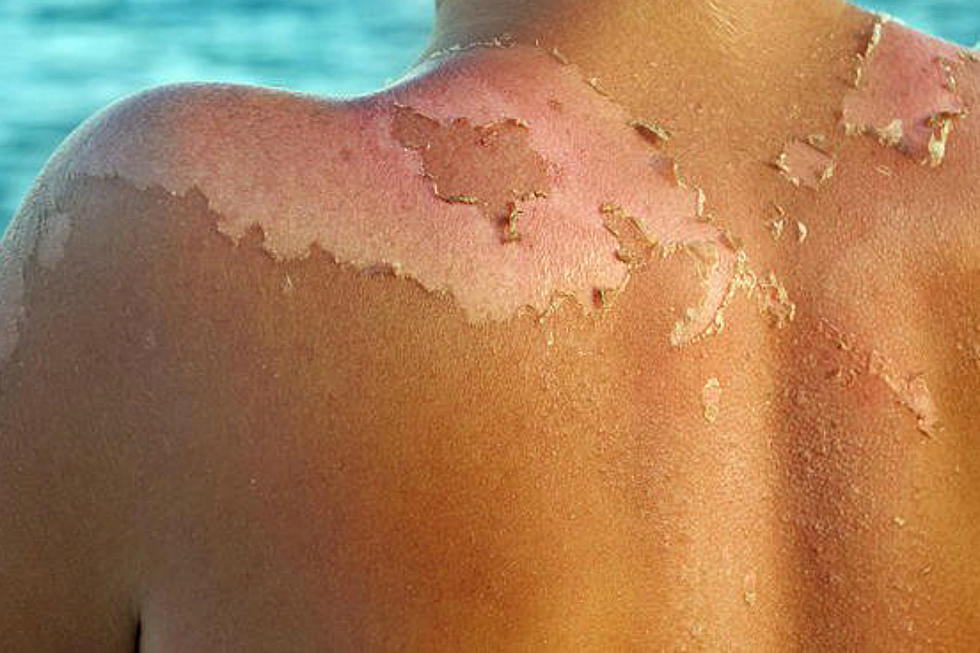 Why Sunscreen Is So Important In Wyoming