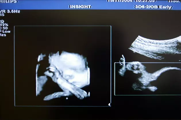 Wyoming Bill Would Require Ultrasounds Before Abortion