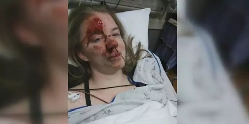 Oregon Teen Knocked Out By Deer During School Fire Drill