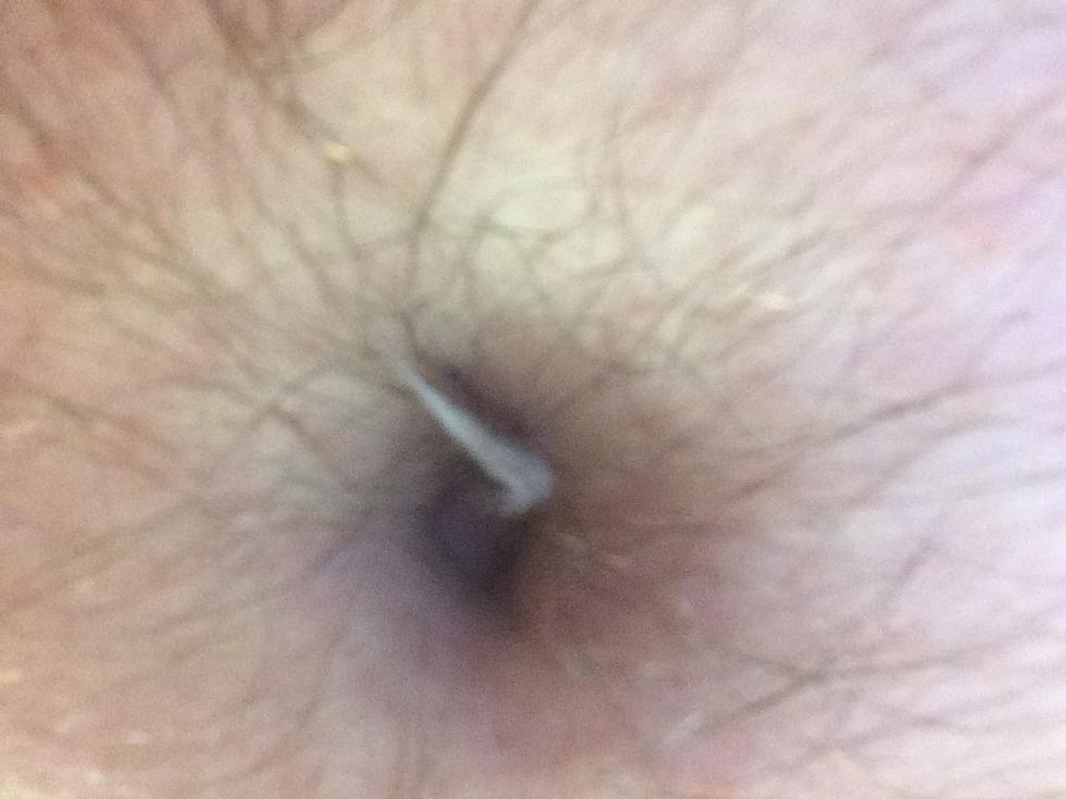 Why Does Picking Out Belly Button Lint Cause Pain Between The Taint And The Base Of Your Manhood?