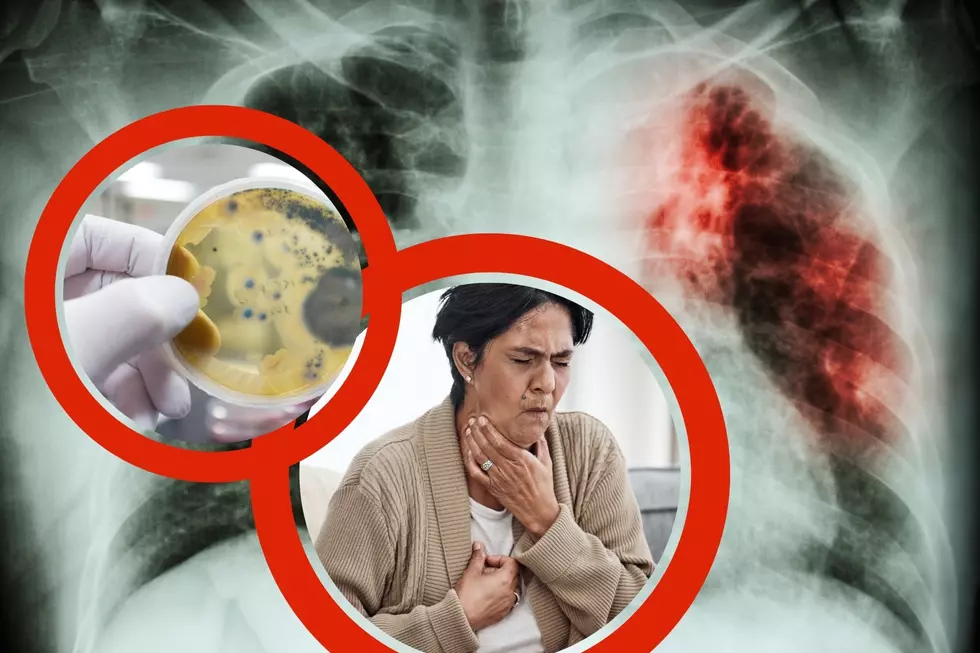 Tuberculosis Causing Health Emergency in this California City