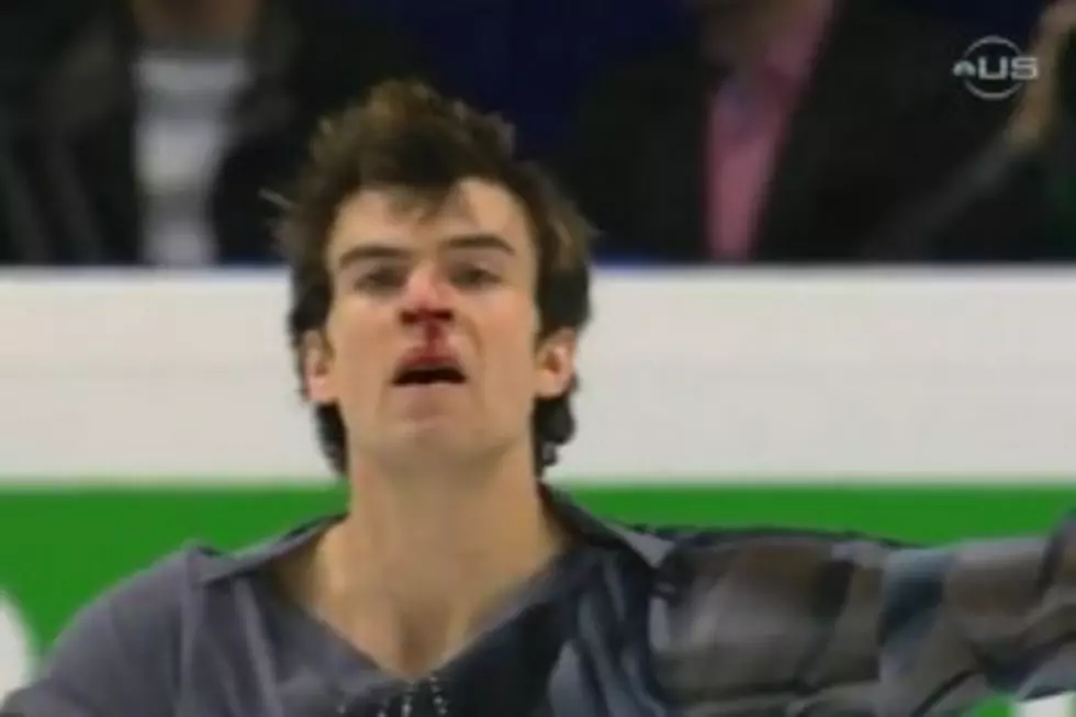 Figure Skater Finishes Routine After Breaking Nose [VIDEO]