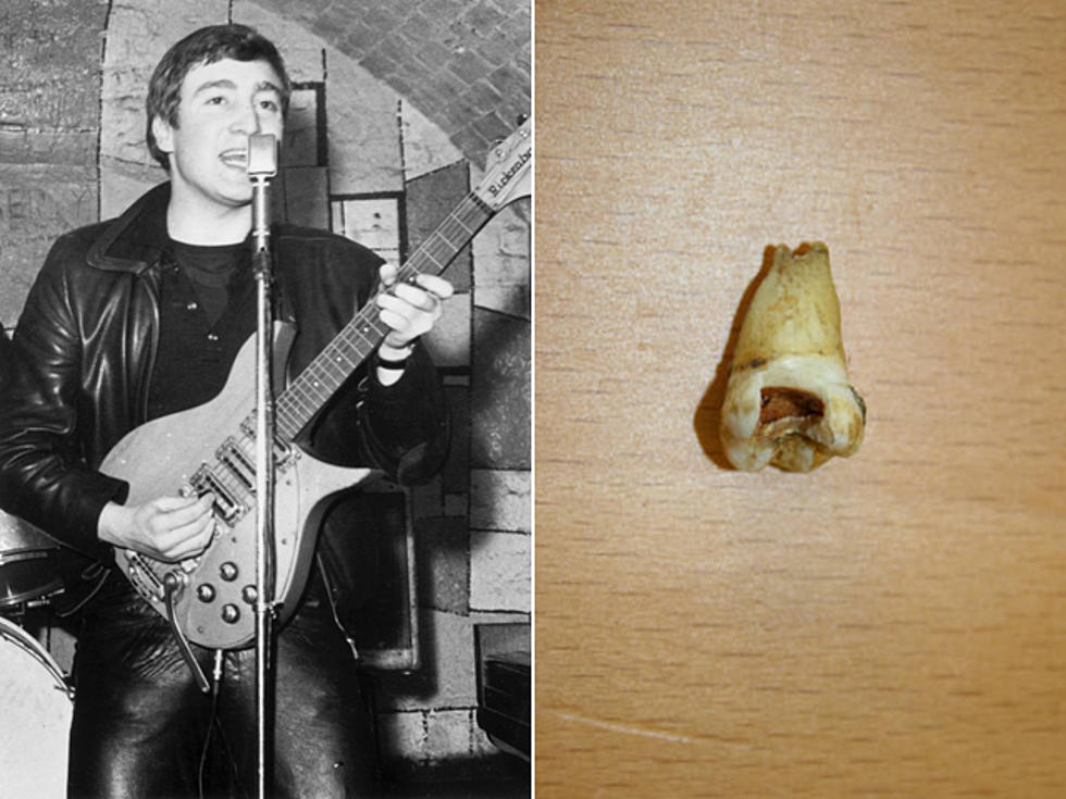 John Lennon’s Tooth Slated for Auction