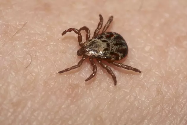 Wisconsin Woman Dies From Rocky Mountain Spotted Fever from Tick Bite