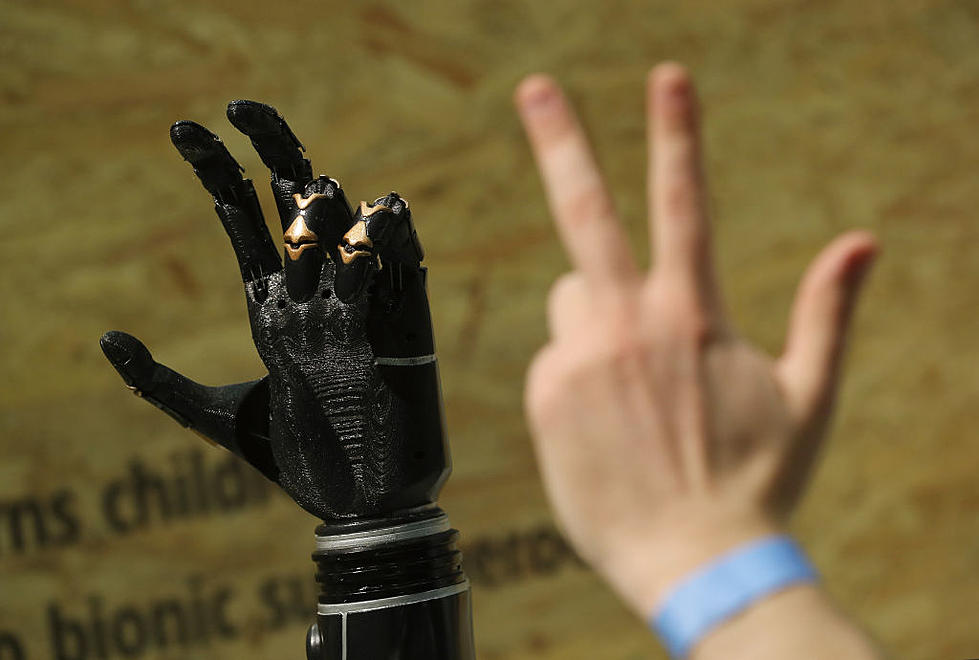 Bionic Arms & The Future Is Here [VIDEO]