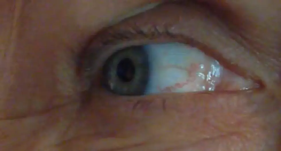 Does a Women&#8217;s Eye Blood Vessels Really Spell &#8216;LOVE&#8217;? [VIDEO]