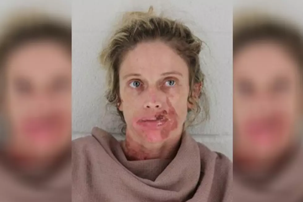 Woman Gets Instant Frostbite on Her Face After Huffing Canned Air at Walmart [PHOTO]