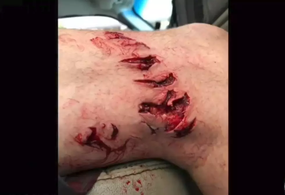 Texas Man Attacked By Shark Near Galveston [Photo]