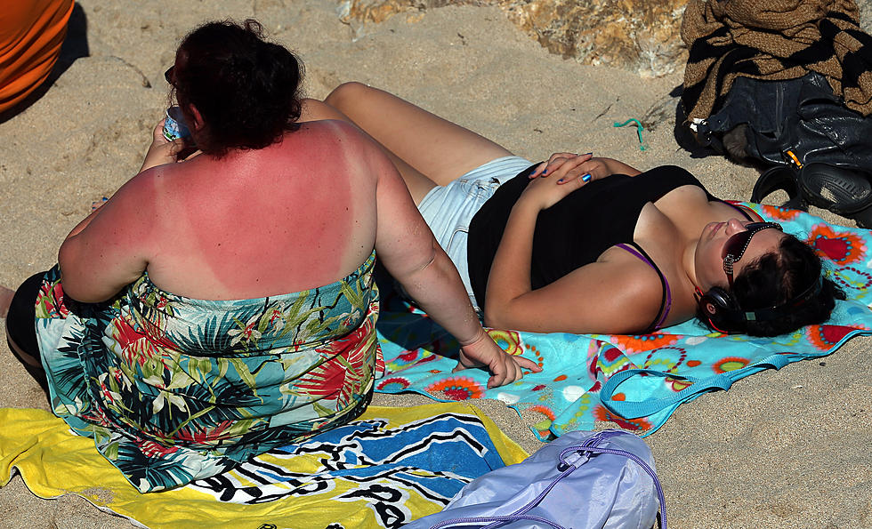 5 Remedies to Relieve Your Sunburn