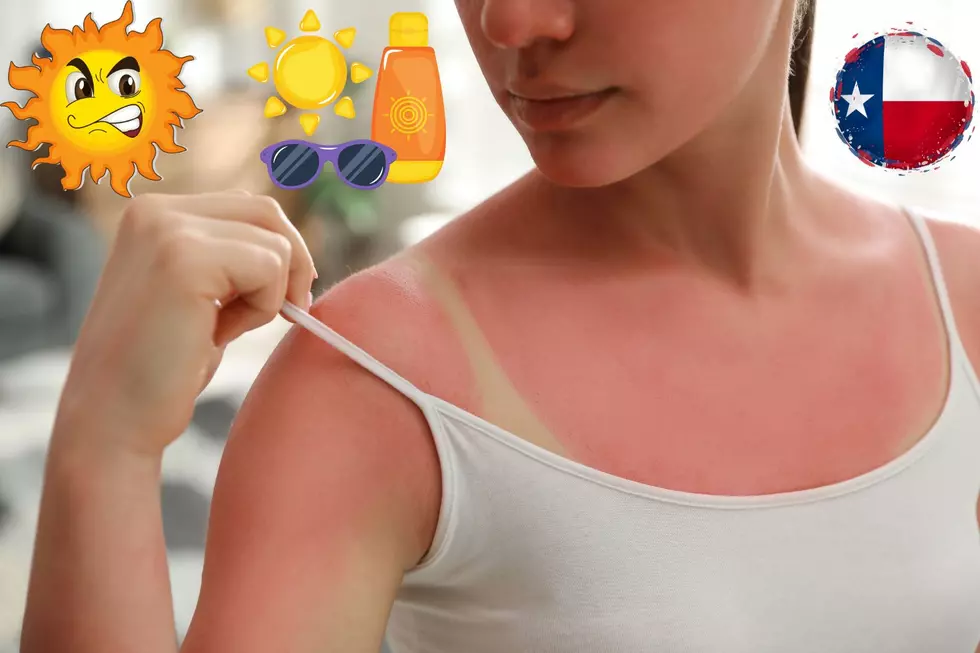 The Best Ways to Treat a Bad Texas Sunburn