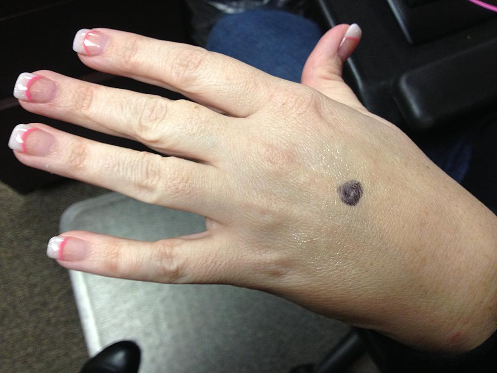 Mommy Blogger April B. –  The Dot on My Hand