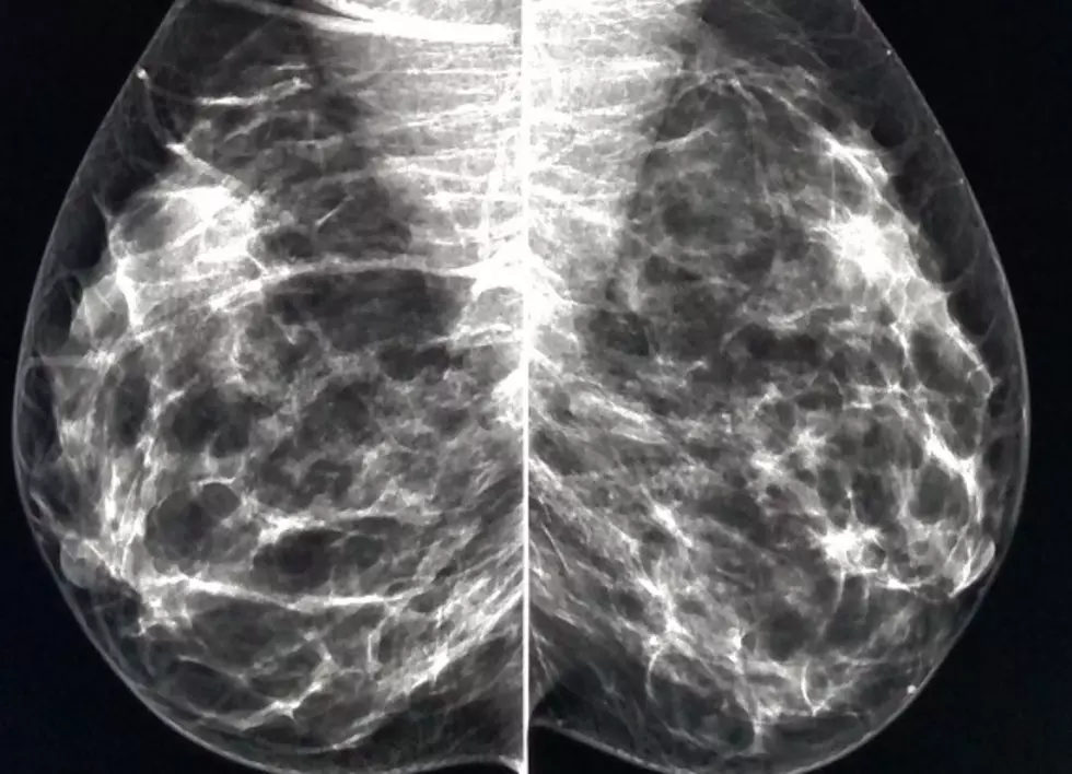How My Mammogram Saved My Mom&#8217;s Life