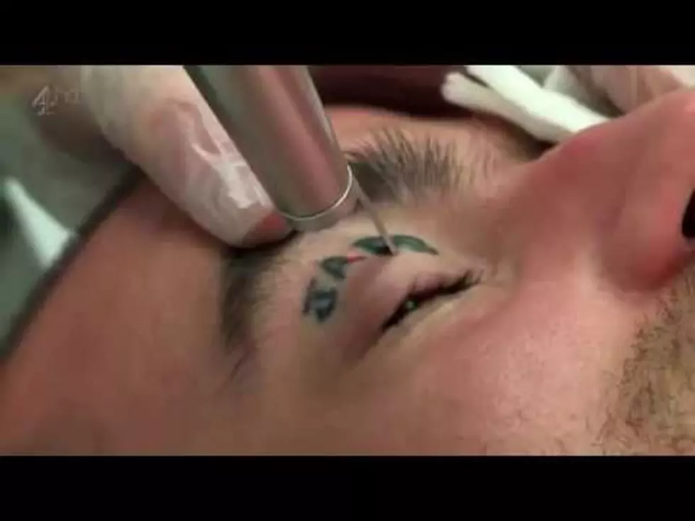 This Tattoo Removal Will Change Your Mind