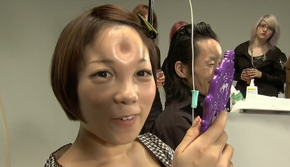Bagel Head: New Body Modification Craze in Japan [VIDEO]