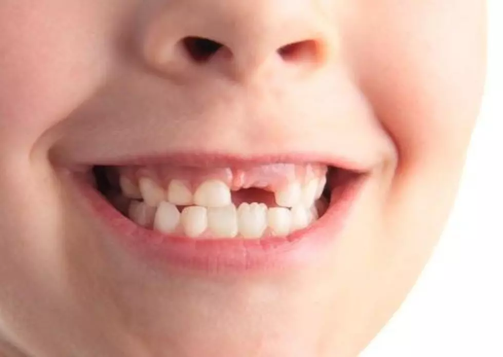 How Much Does The Tooth Fair Pay Per Tooth In 2015? [POLL]