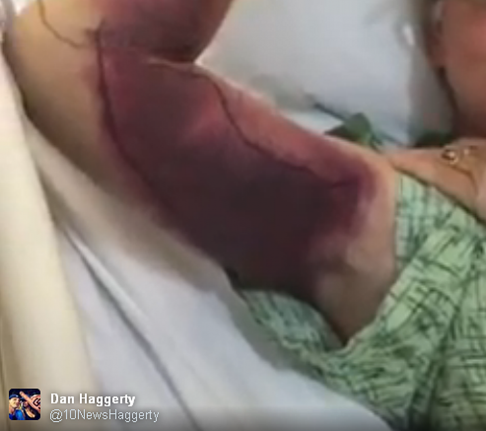 A Selfie Cost This Man a Hospital Stay and Over $150,000! [VIDEO]