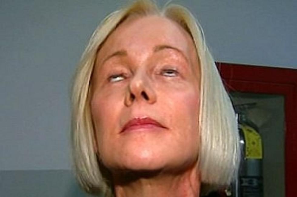 Plastic Surgery Gone Awry, Woman Can’t Close Her Eyes [VIDEO]