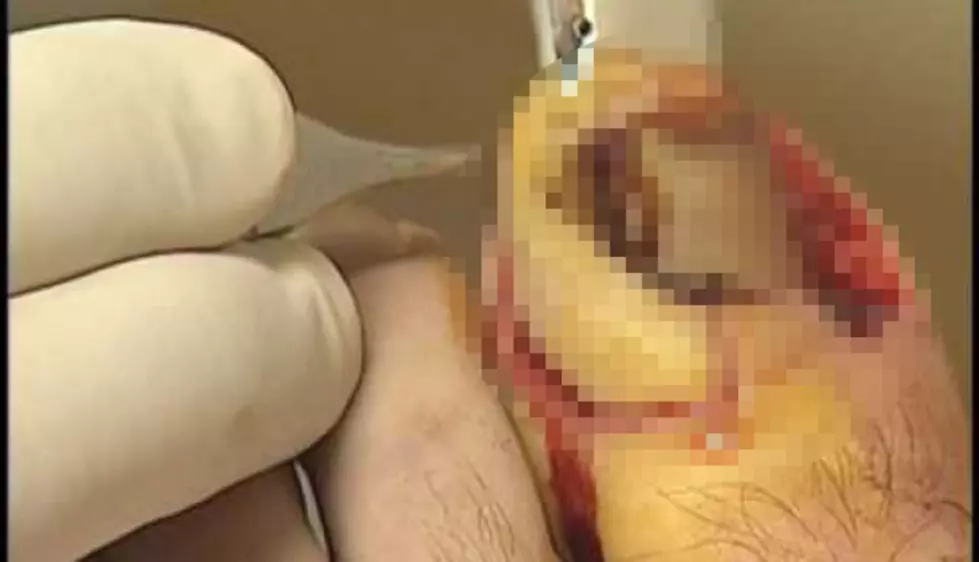Another Five Gross Videos to Make Your Stomach Turn [NSFW Videos]