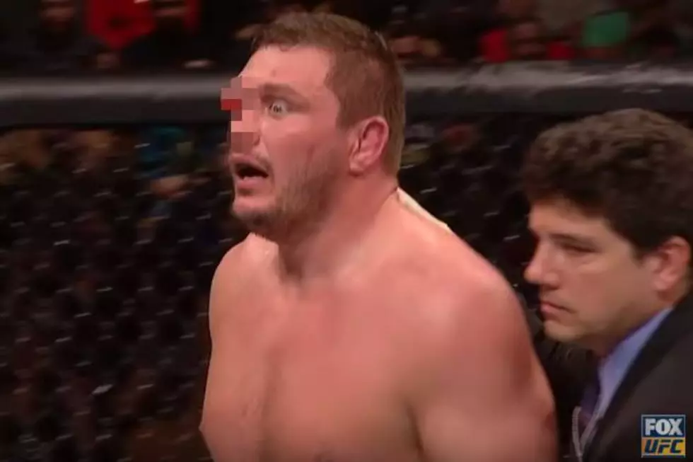 UFC Fighter&#8217;s Eye Blows Up Like a Balloon [VIDEO]