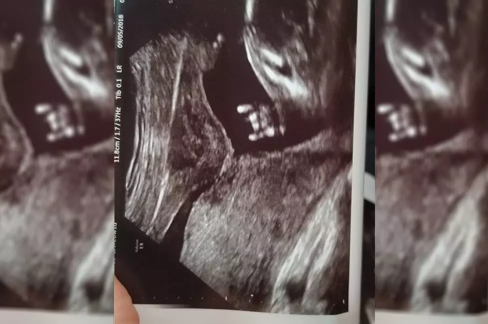 Texas Baby Throws Up Hook’em Horns Hand Sign While in the Womb