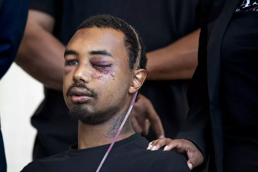 Dallas Man Loses Eye and Some Teeth To Less Lethal Round During Protest