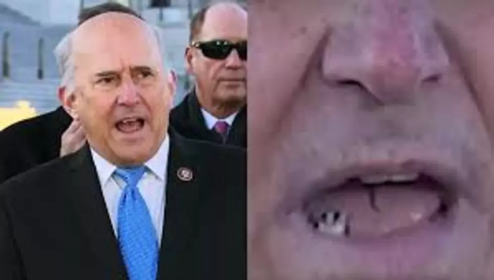 Texas Representative Loses Tooth During Press Conference