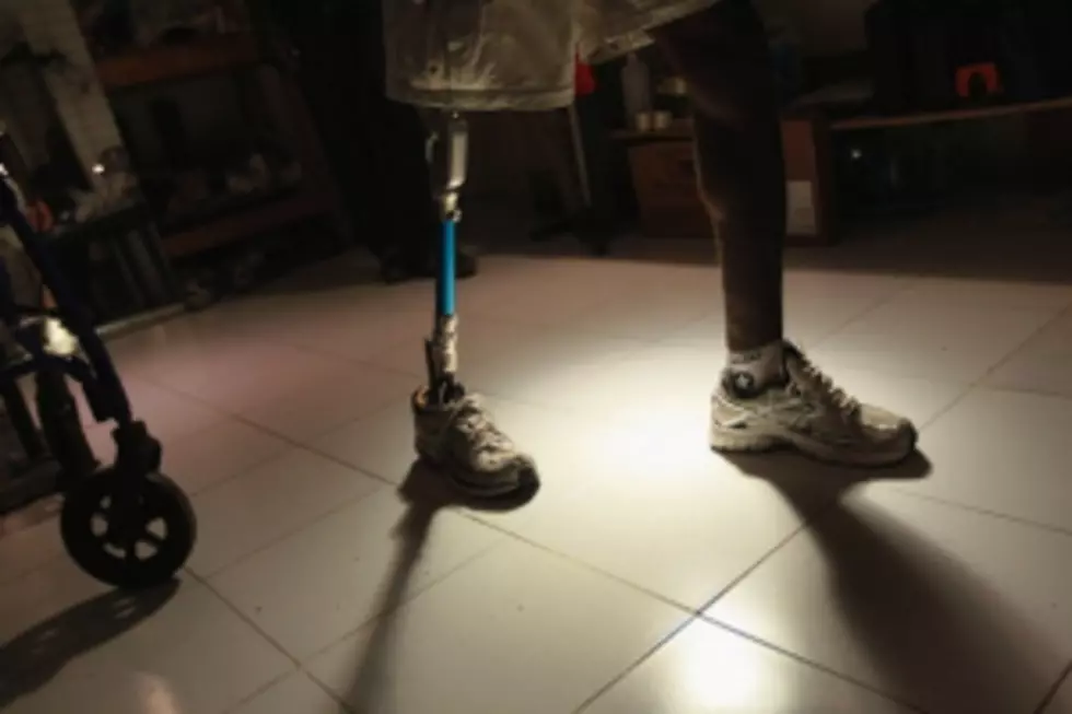 Man Uses Prosthetic Leg to Take Down Armed Robber