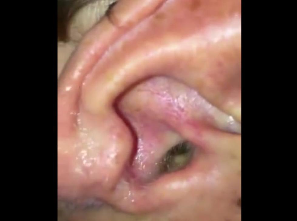 Spider Crawls Out of Man&#8217;s Ear, Then Crawls Back In [VIDEO]