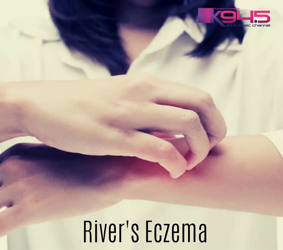 If Your Child Struggles with Eczema, Watch This Video