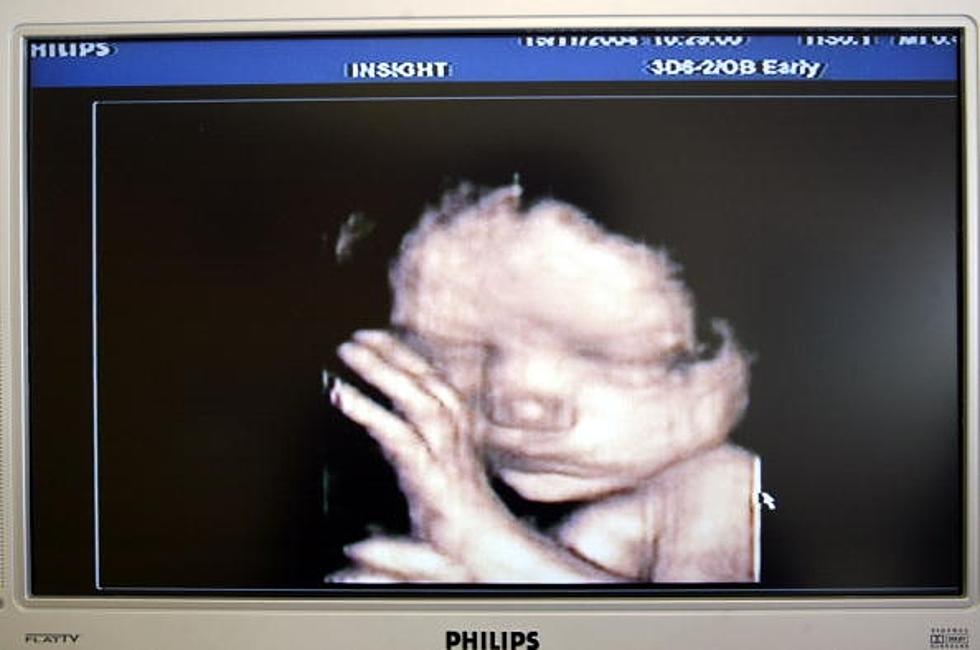 Lawsuit Filed Against New Texas Law Requiring Sonograms Before Abortions