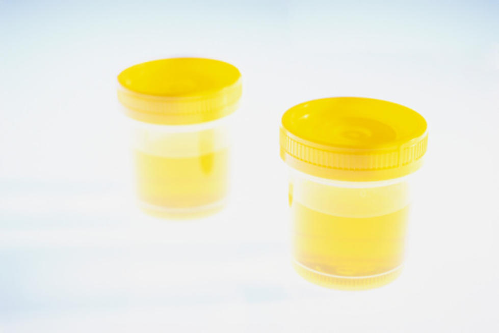 Researchers Create Chip To Dectect Prostate Cancer in Urine