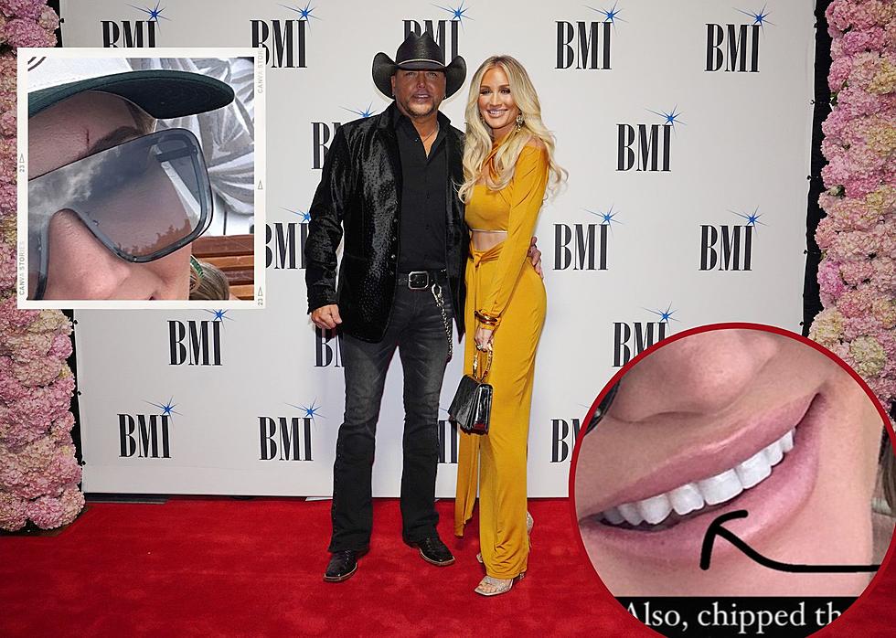 Brittany Aldean Explains How She Chipped a Tooth, Scratched Her Face [Pictures]
