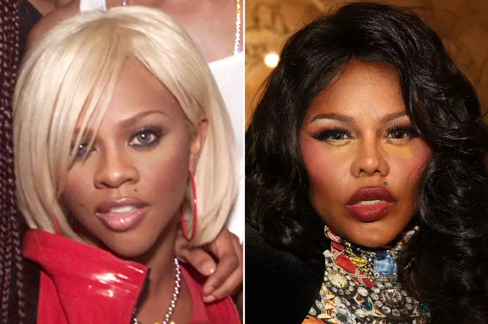 Shocking Celebrity Face Transformations [PHOTOS]