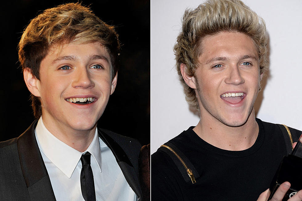 Celebrities’ Teeth Transformations – Before and After [PHOTOS]