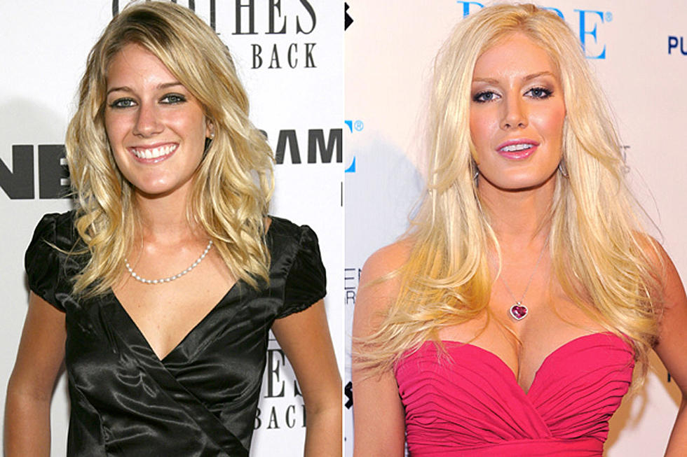 Celebrities’ Plastic Surgery: See Before and After Photos