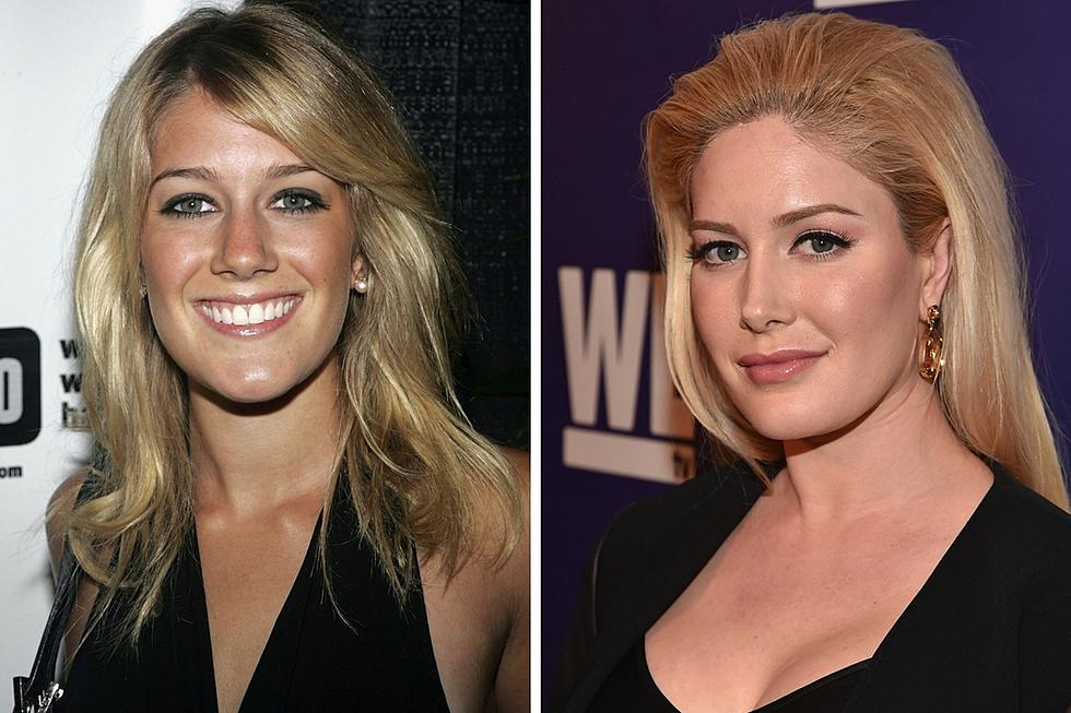 Heidi Montag: I “Died for a Minute” During My Plastic Surgery