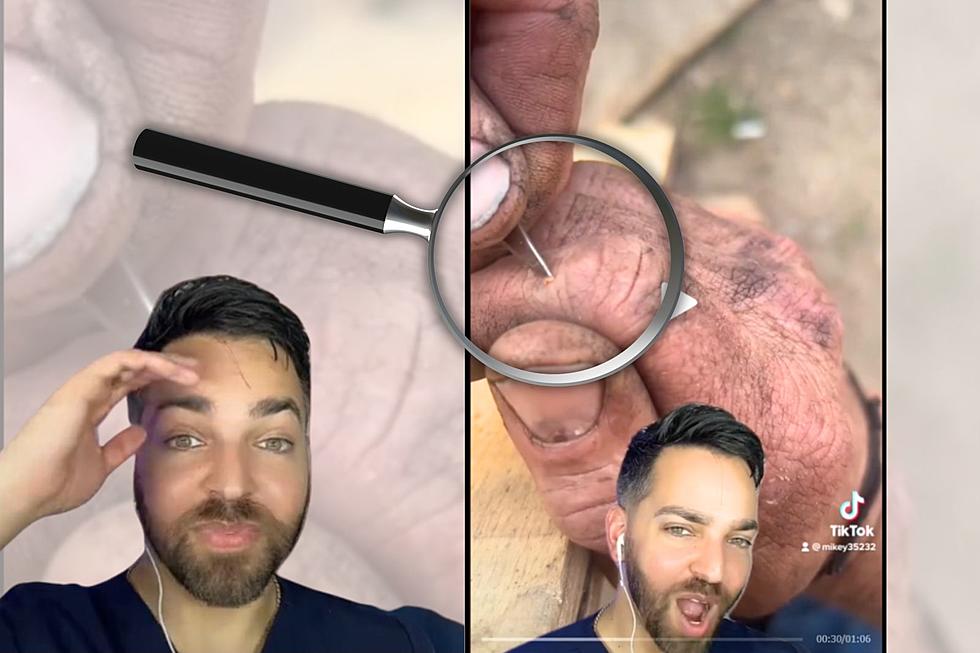 What This Guy Just Pulled Out of His Skin Will Have You SHOOK (VIDEO)