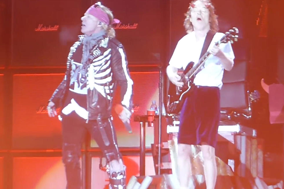 Axl Rose Is Back on His Feet (Partially)