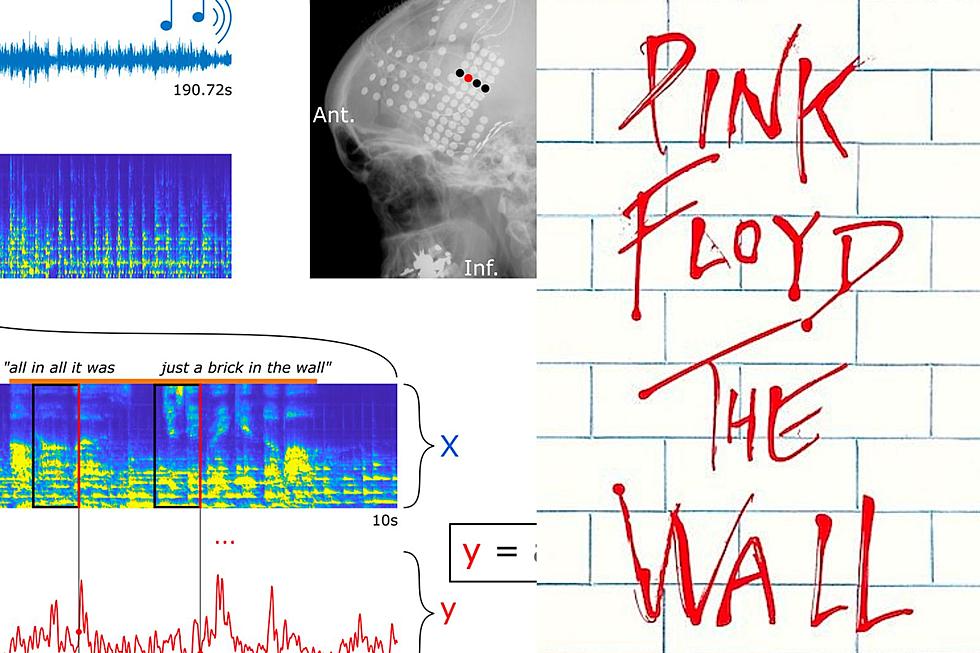 Neuroscientists Recreate Pink Floyd Song With Patient Brain Waves