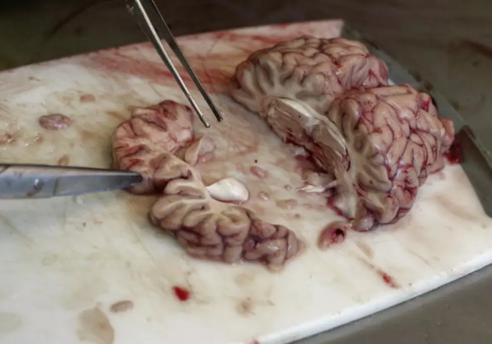 Cow Brains Seized By Customs Officials at Cairo Airport