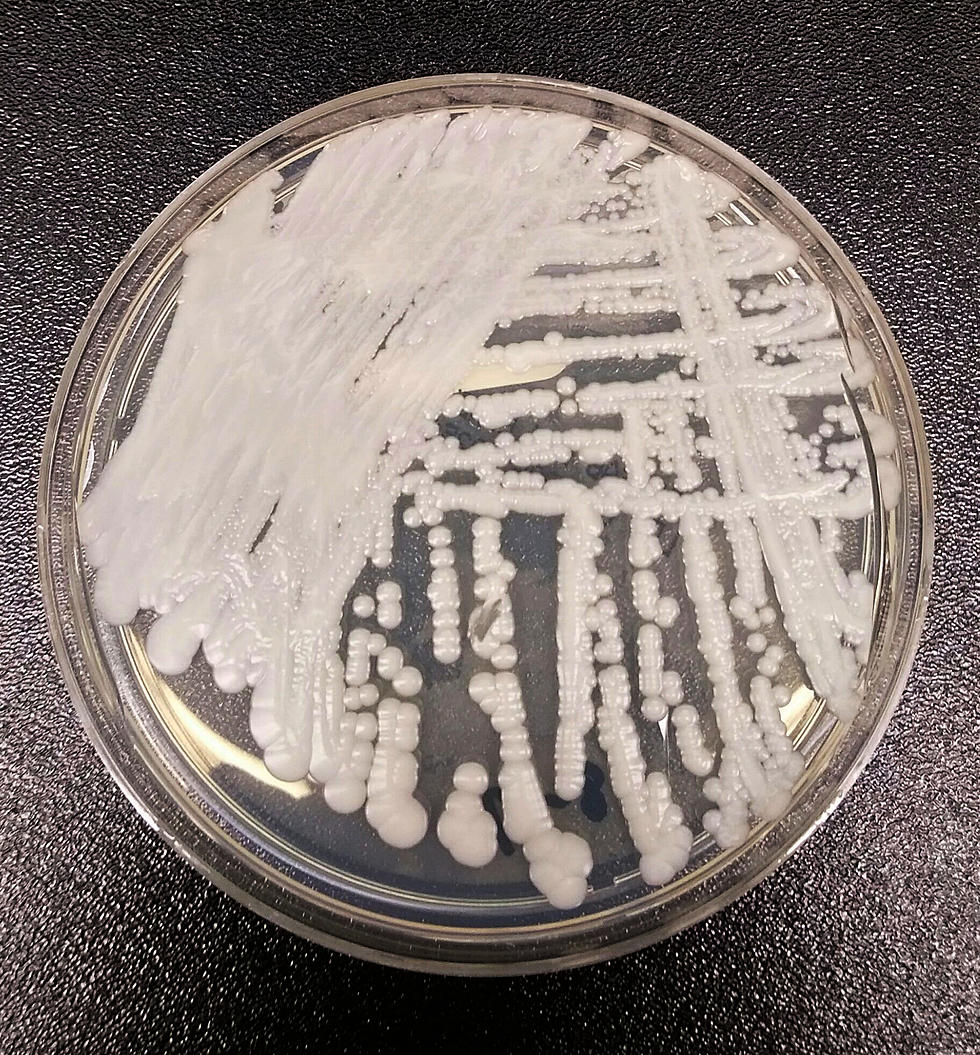 CDC Warns of ‘Potentially Deadly’ Candida Auris Fungus Spreading Through U.S.