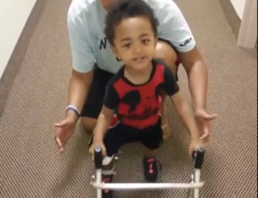 Two-Year-Old With Prosthetic Legs Takes First Steps, Says ‘I Got It’ [VIDEO]