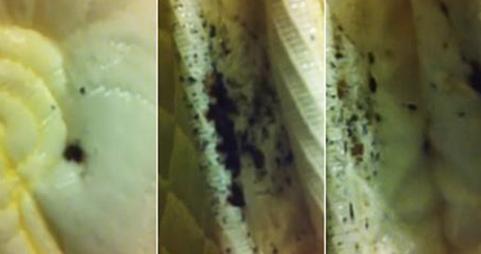 Couple Videotapes Bedbug Infestation At NYC Hotel [VIDEO]
