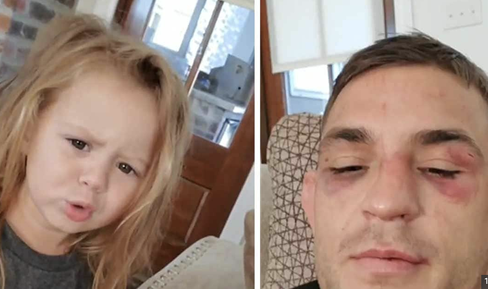 Dustin Poirier’s Daughter Had The Most Adorable Reaction After Seeing His Fight Injuries