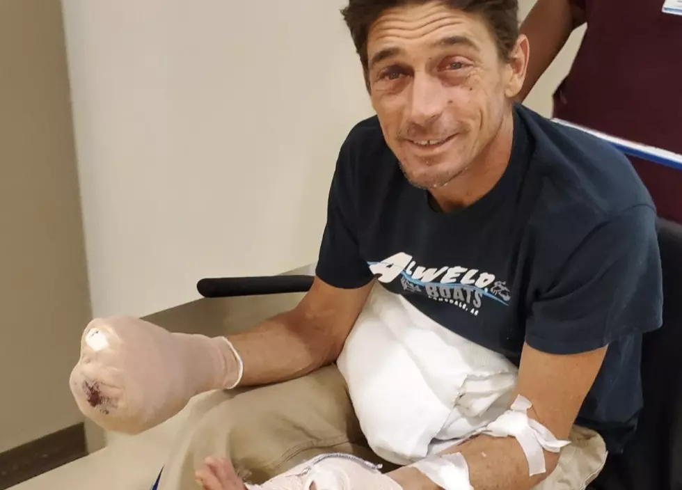 ‘Swamp People’ Star Tommy Chauvin Severely Injured In Accident [PHOTOS]