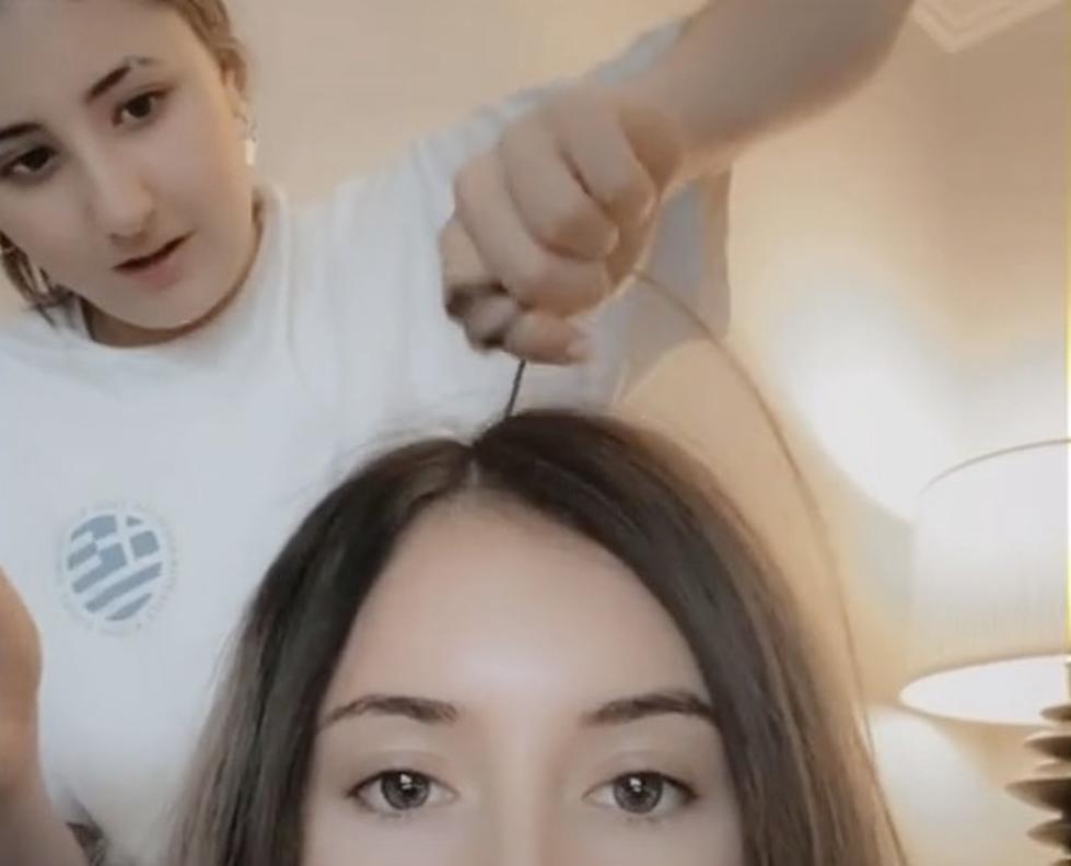 Scalp Popping Trend is Back on TikTok, Doctors Say to Not Do This