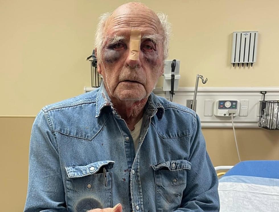 87-Year-Old Louisiana Man Beaten and Robbed [GRAPHIC PHOTOS]