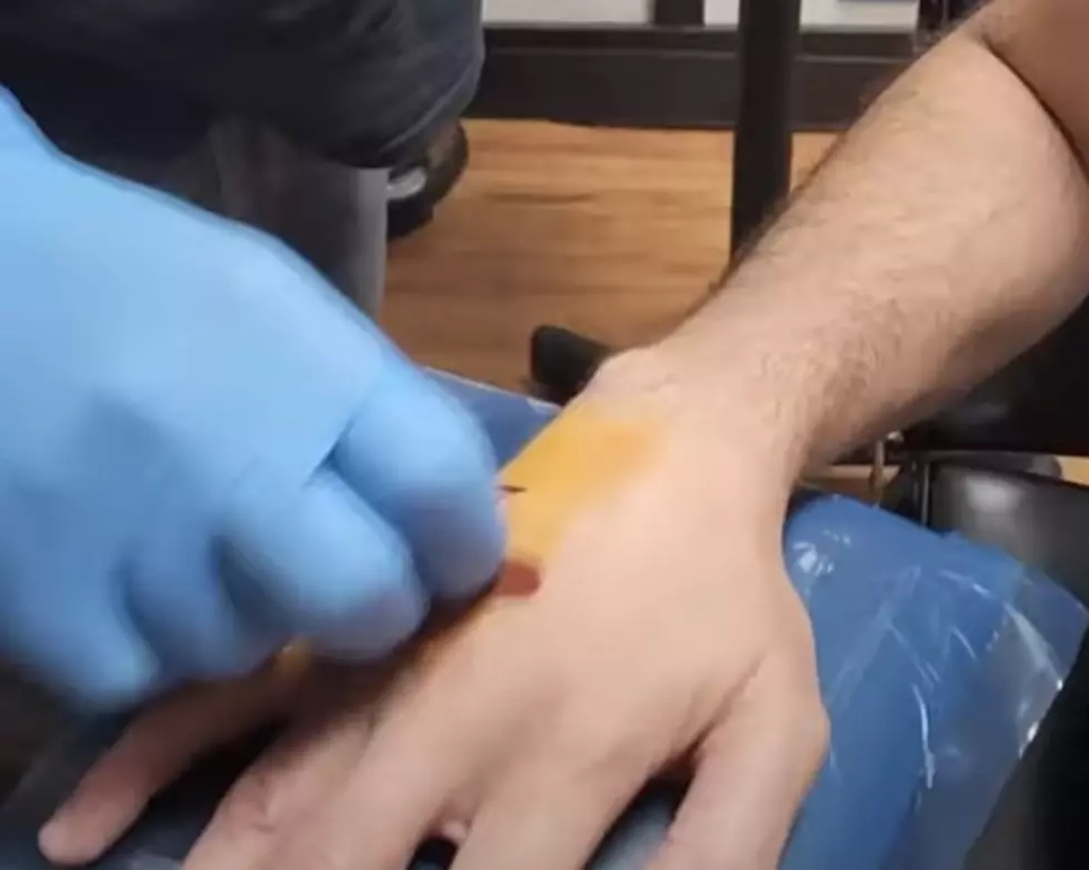Man Has Chip Implanted Into Hand to Unlock and Start Car [VIDEO]