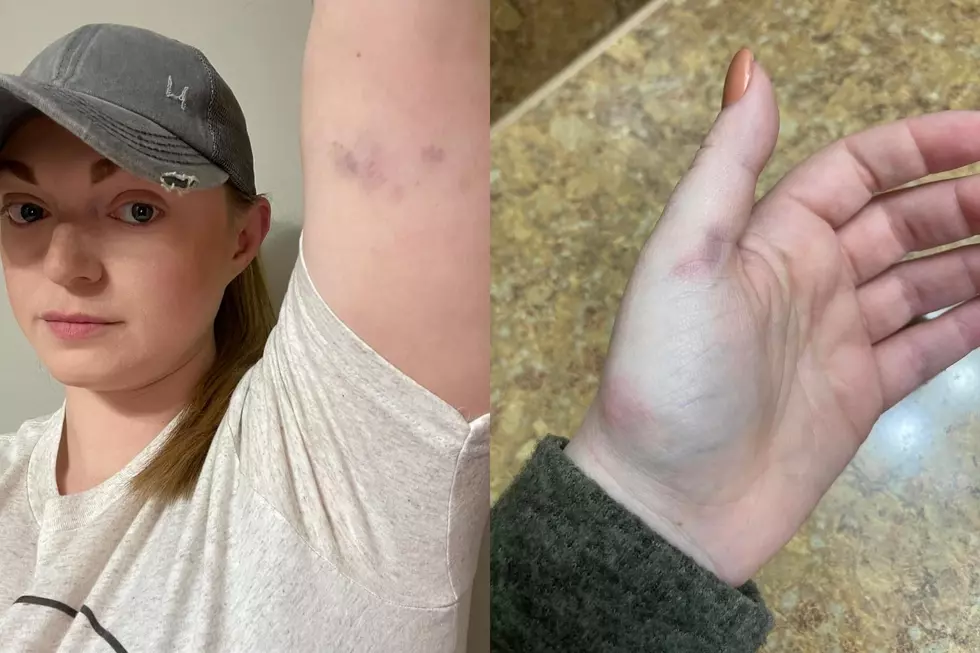 Local Woman Left Bruised, Claims Church Point Police Used Unnecessary Force During Arrest Over Tint