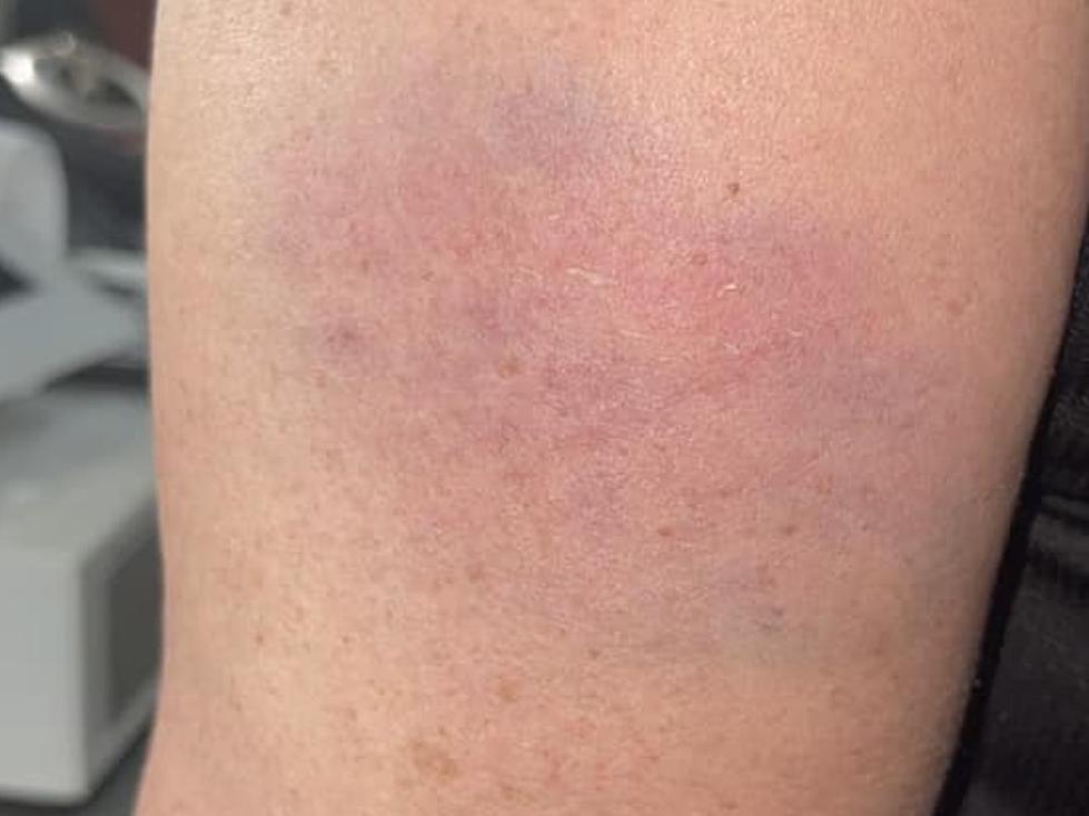 Lafayette Woman Left Bruised After Purse Snatching Incident in Parking Lot